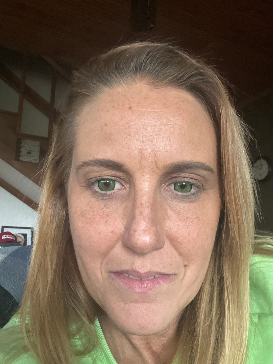 Customer photo review of Vega Bright Forest Green Prescription Colored Contact Lenses