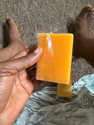 Customer photo review of Anti-Acne & Dark Spots African Soap