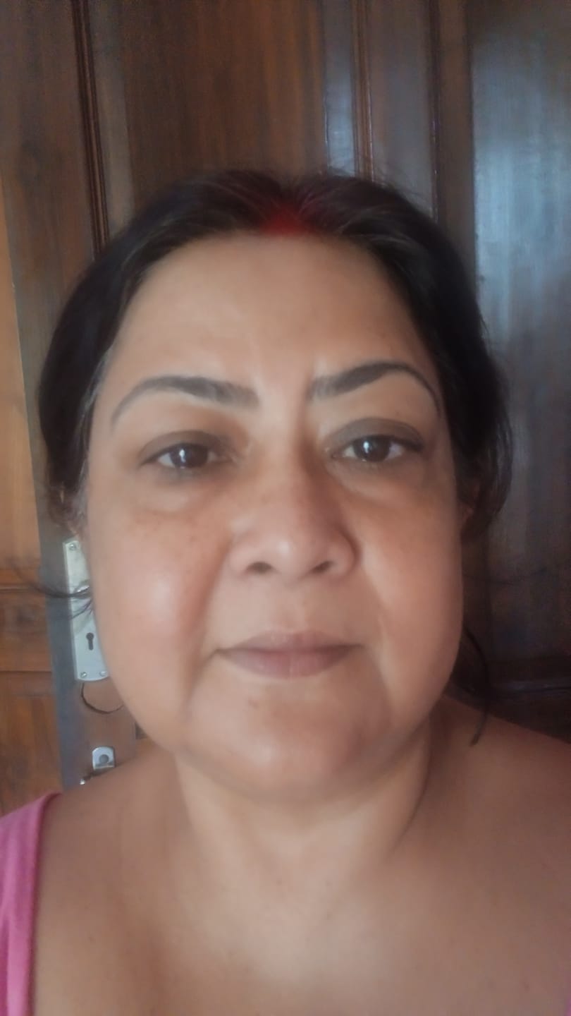 Customer photo review of Vitamin C Skin Brightening Face Serum