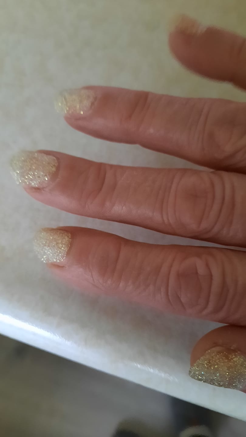 Customer photo review of Peel Off Base Coat