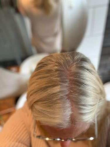 Customer photo review of Sunkissed Starter Kit