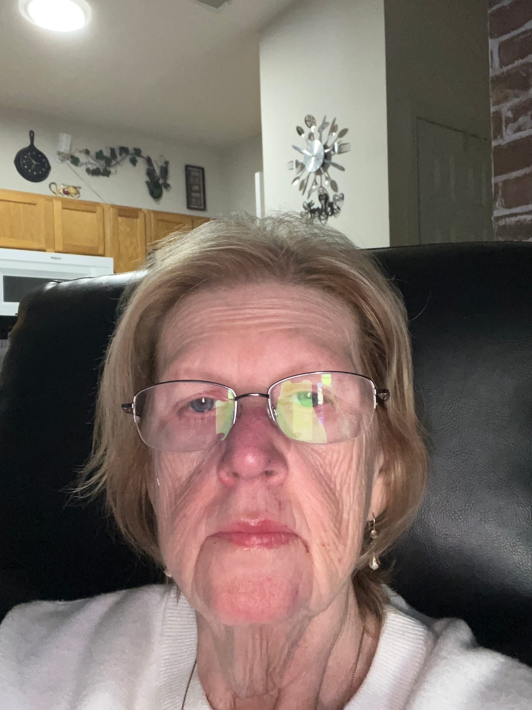 Customer photo review of OPTASE® HYLO Relief™ Dry Eye Drops