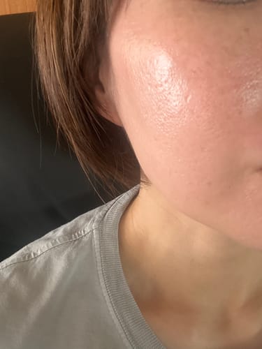 Customer photo review of TAホワイトセラムMD(医薬部外品)