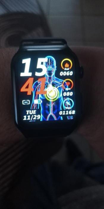 Customer photo review of Bearscome Pro 6 ECG blood glucose Intelligent micro-physical examination Stress monitoring Smartwatch