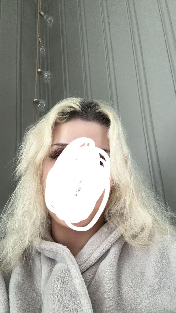 Customer photo review of Hair Growth Bundle