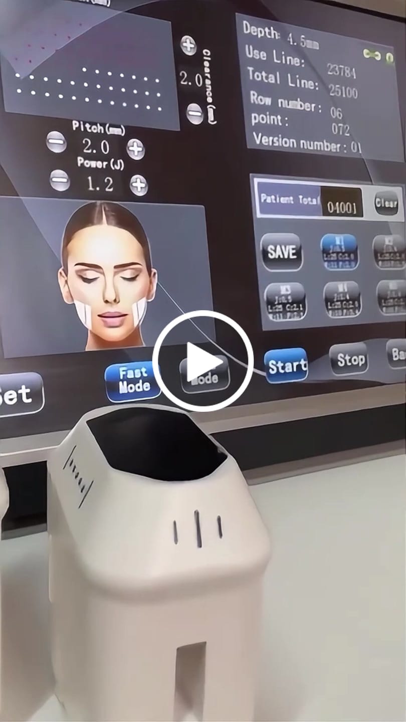 Customer video review of HIFU Machine 4D Classic