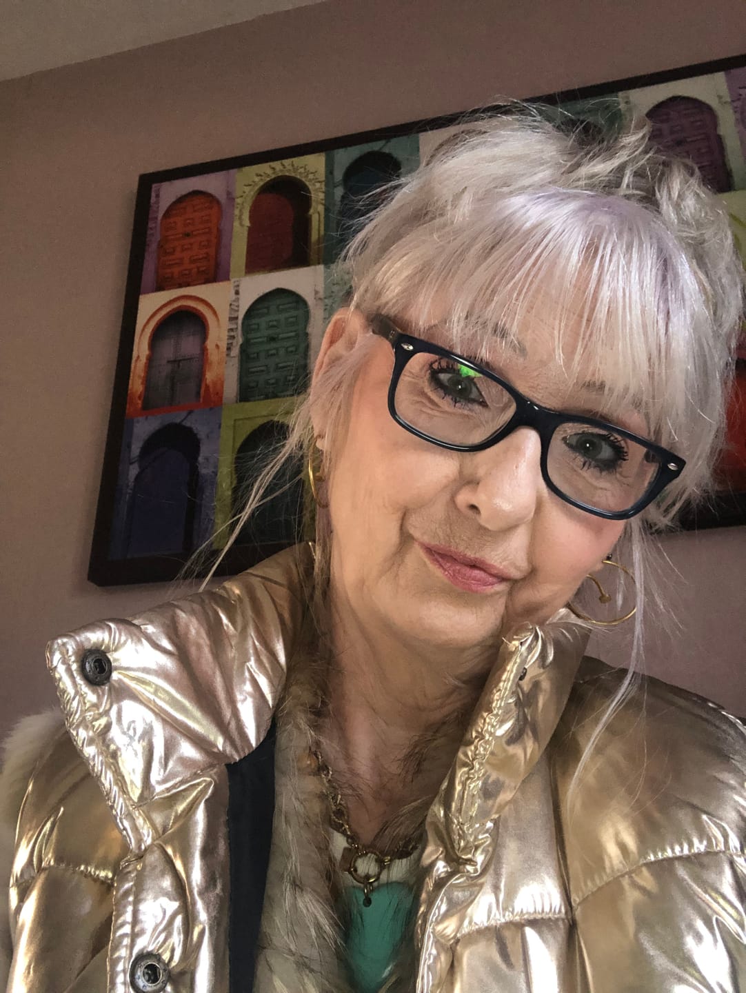Customer photo review of RÉTINOL (VITAMINE A) - 60 GÉLULES