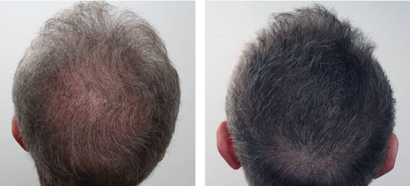 Ronni A. review of MensMen™ - Magicolour für selbstbewusstes voluminöses Haar