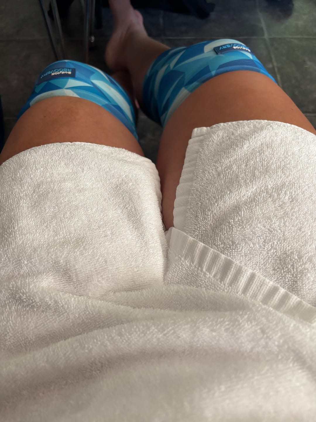 Customer photo review of Medium Hot & Cold Compression Gel Sleeve