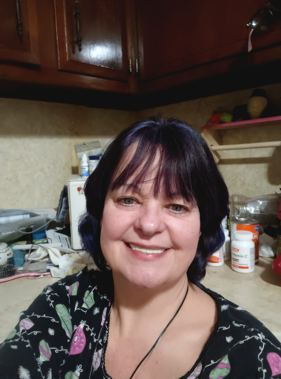 Customer photo review of Imako® Teeth Replacement Back Layer