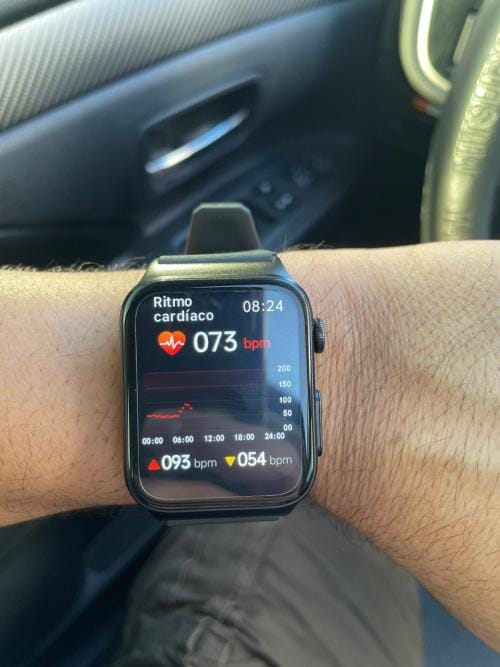 Customer photo review of Bearscome Pro 6 ECG blood glucose Intelligent micro-physical examination Stress monitoring Smartwatch