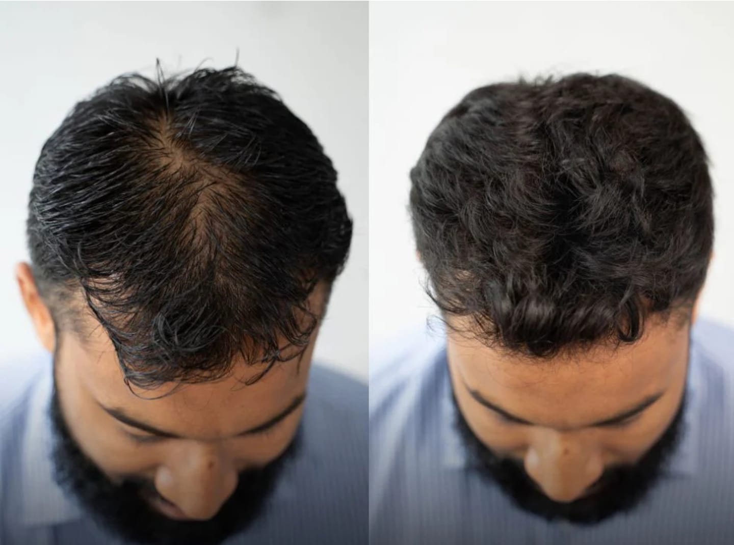 Mohammed O. review of MensMen™ - Magicolour für selbstbewusstes voluminöses Haar