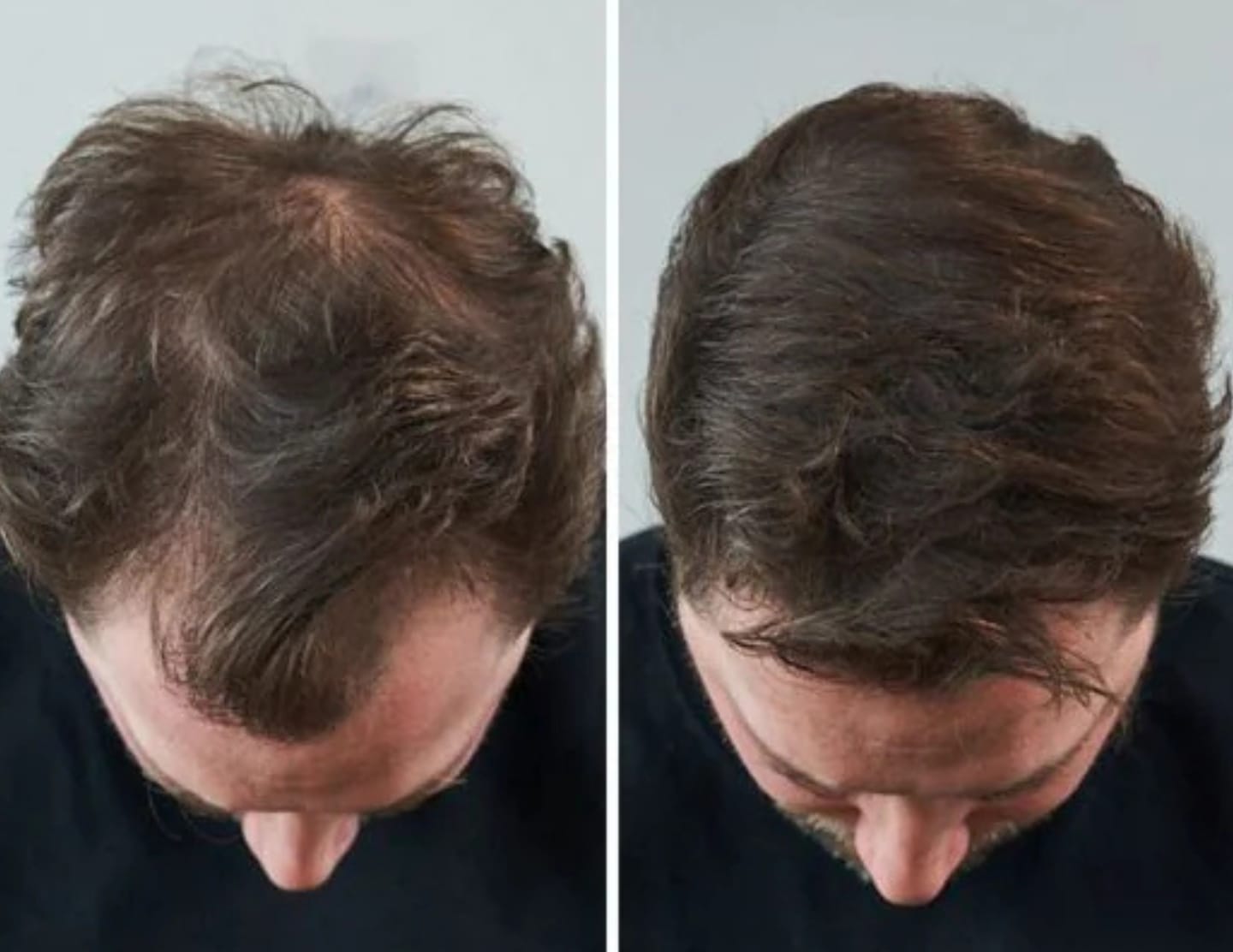 Sebi P. review of MensMen™ - Magicolour für selbstbewusstes voluminöses Haar