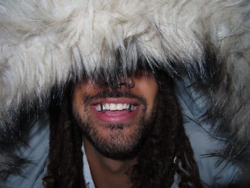 Customer photo review of ZOLARA (SILVER GRILLZ)