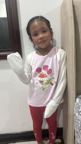 Customer photo review of Eczema Scratch Mitten