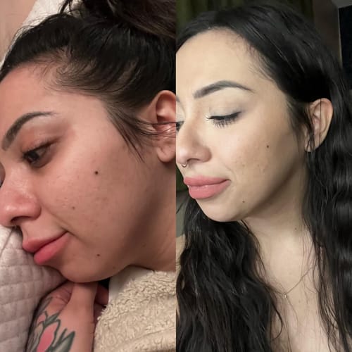 Customer photo review of Facial Muscle Stimulator