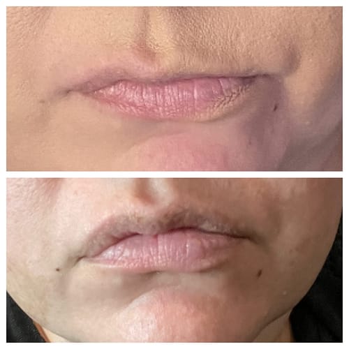 Customer photo review of Facial Muscle Stimulator