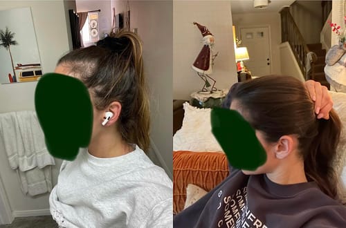 Customer photo review of Anti Hair-Thinning Serum