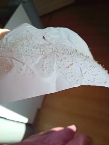 Customer photo review of LANBÉNA Blackhead Remover Mask