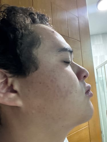 Customer photo review of Formula Personalizada Rx