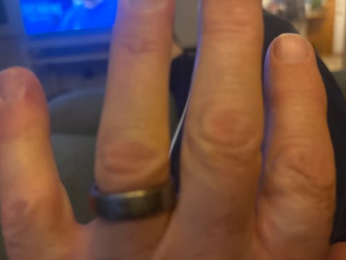 Customer photo review of Warrantied Ring Replacement