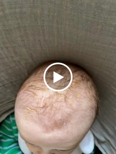 Customer video review of Happy Scalp Cream™