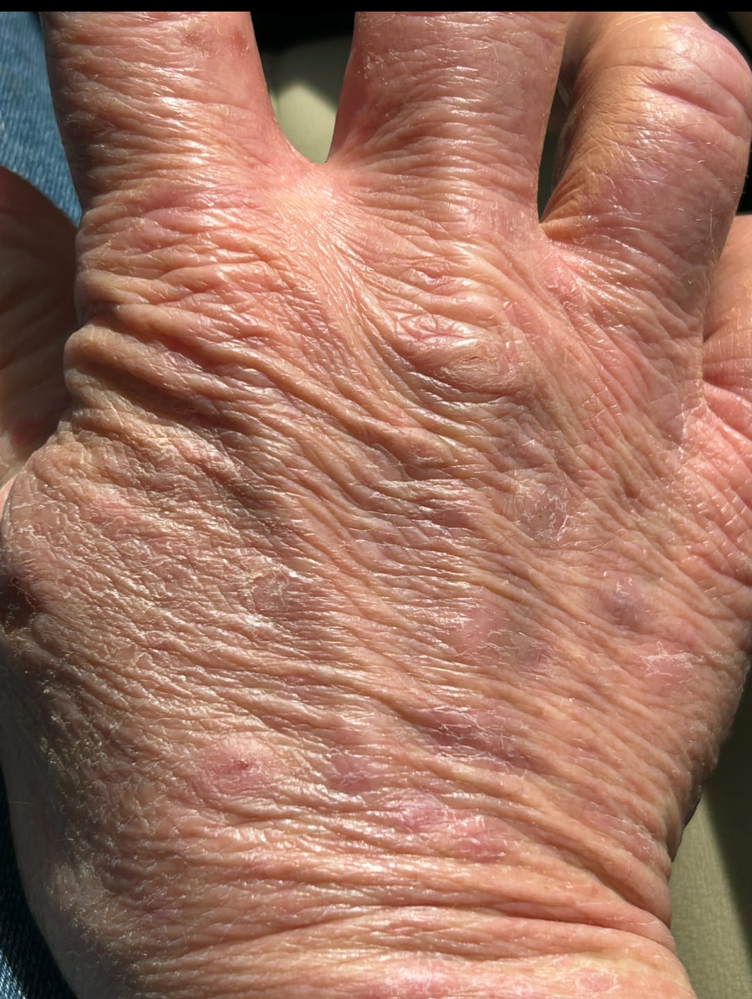 Customer photo review of Copper Peptide GHK-CU Therapy Kit