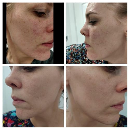 Customer photo review of Facial Muscle Stimulator