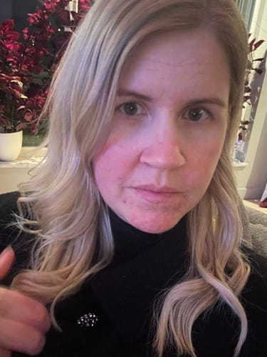 Customer photo review of Sunkissed Refill 1-pack