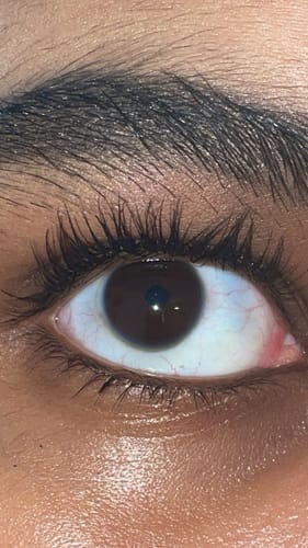 Customer photo review of Lash Growth Serum