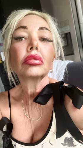 Customer photo review of Long Lasting Lip Plumper