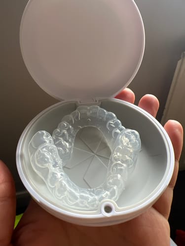 Customer photo review of Professional Whitening Trays