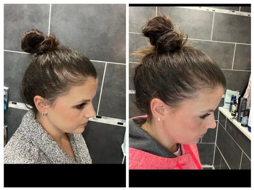 Customer photo review of Anti Hair-Thinning Serum