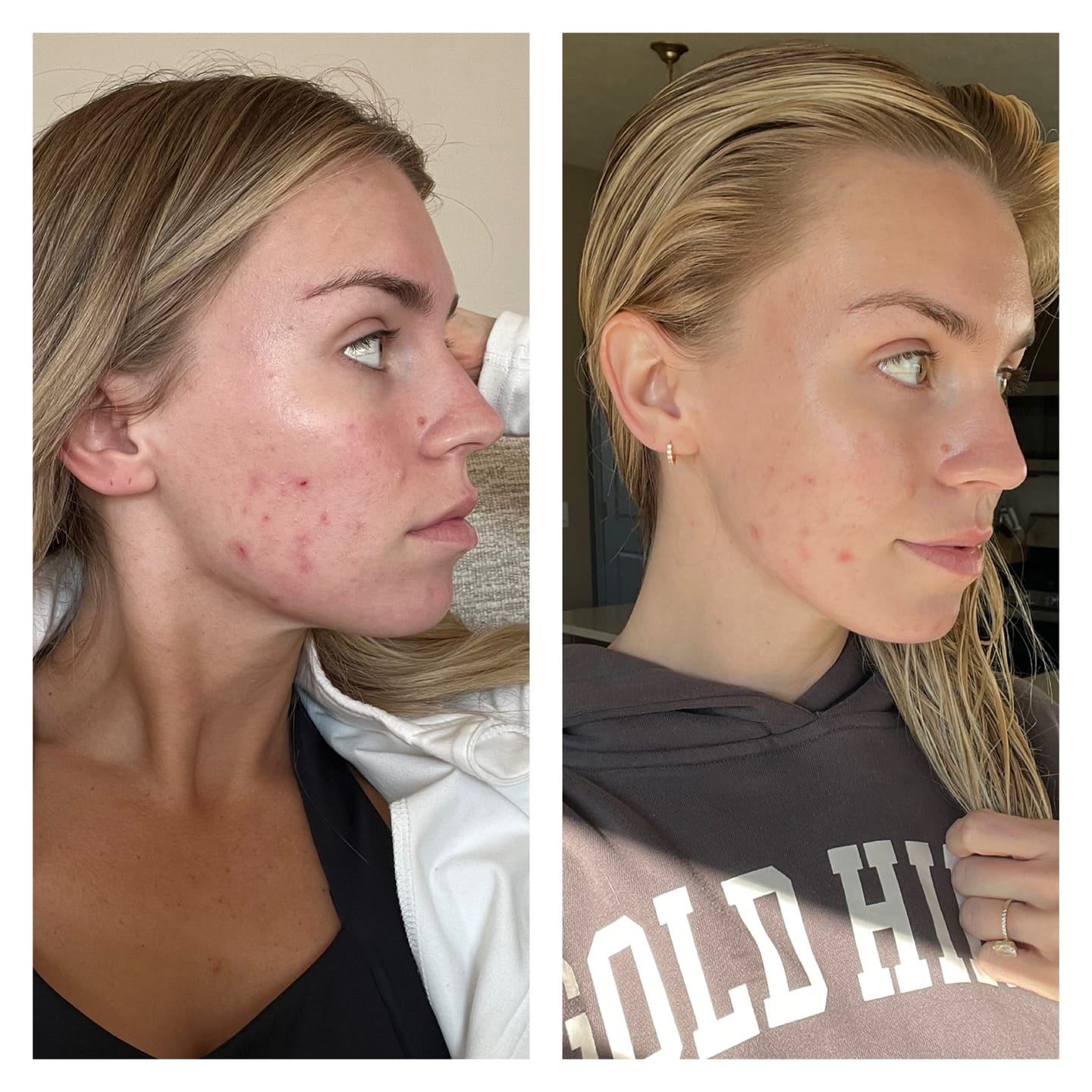 Customer photo review of GLOW RED LIGHT WAND