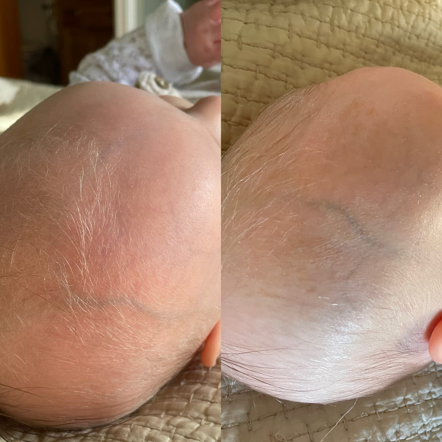 Customer photo review of Baby Scalp Oil