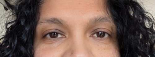 Customer photo review of Organic 'Miracle' Eye Cream (Over 99% Natural)