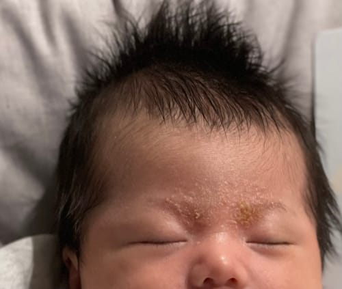 Customer photo review of Happy Scalp Cream™