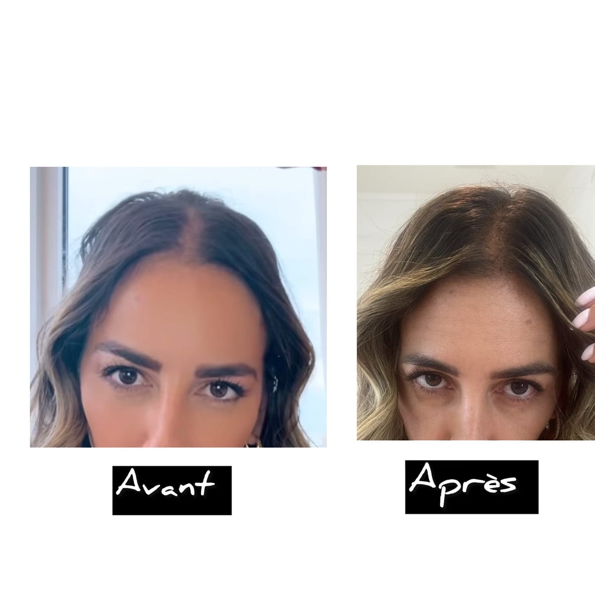Customer photo review of Glow Hair - Pousse accélérée et anti-chute