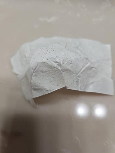 Customer photo review of LANBÉNA Blackhead Remover Mask