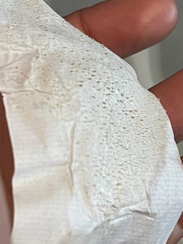 Customer photo review of LANBÉNA Blackhead Remover Mask