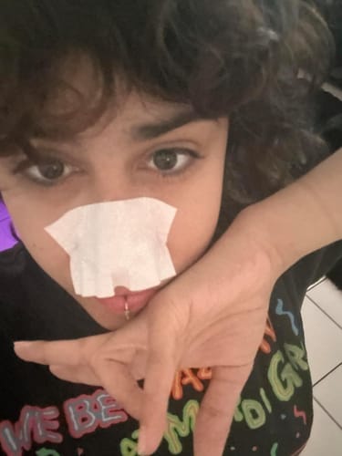 Customer photo review of LANBÉNA Blackhead Remover Mask