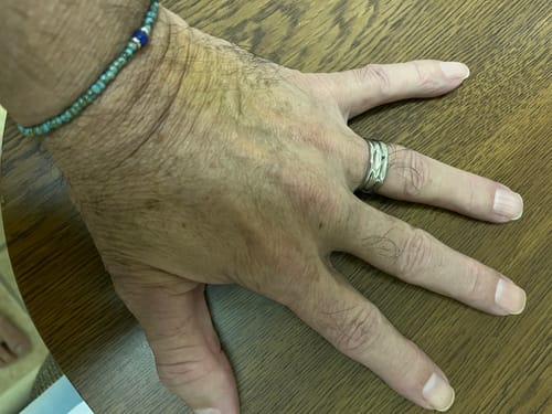 Customer photo review of UNISIZE AMSTERDAM RING