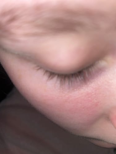 Customer photo review of iGlow Lash Maximizer - Lash Serum, 3 ml