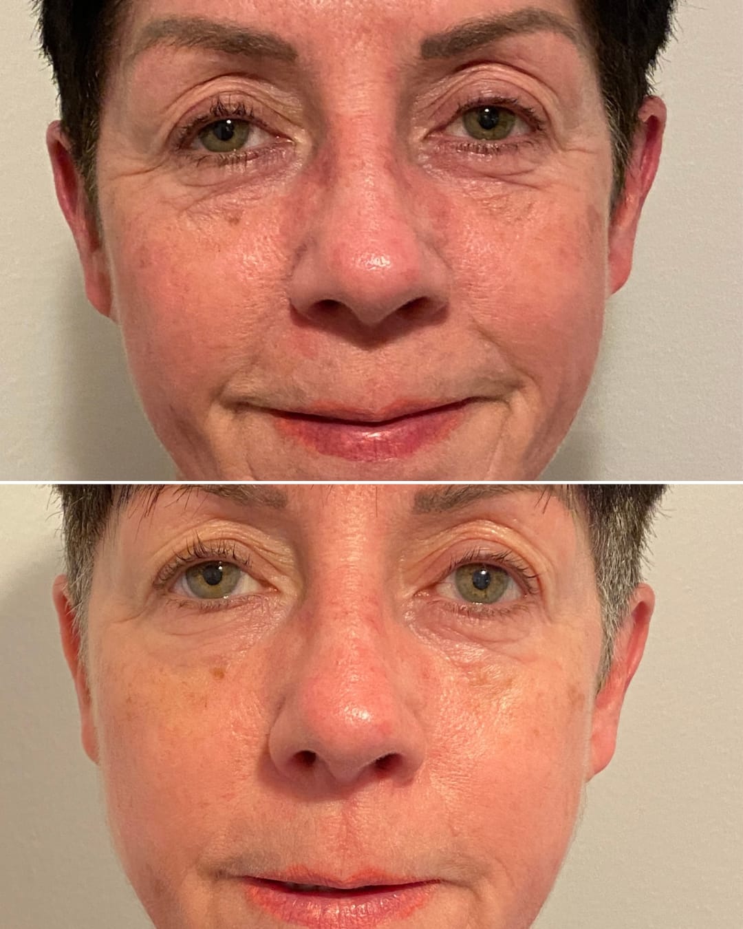 Customer photo review of Bakuchiol Cream