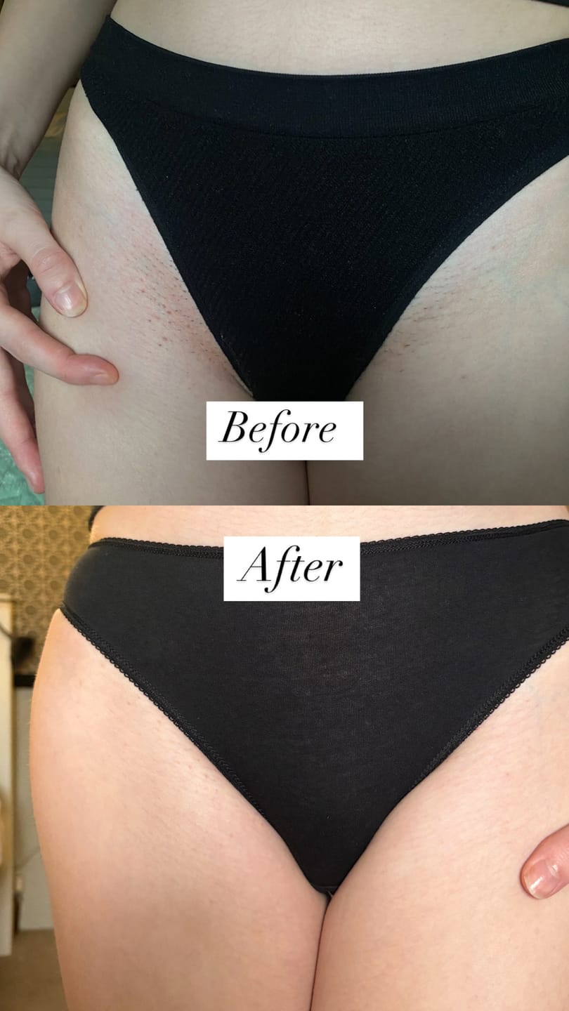 Customer photo review of Superfood Intimate Care Kit