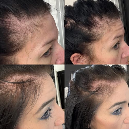Customer photo review of Hair Growth Kit