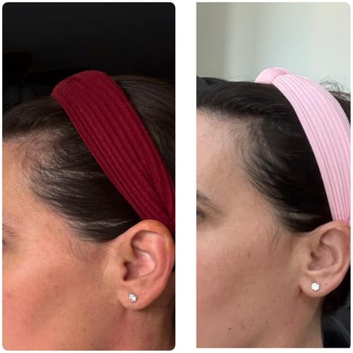 Customer photo review of Hair Growth Kit