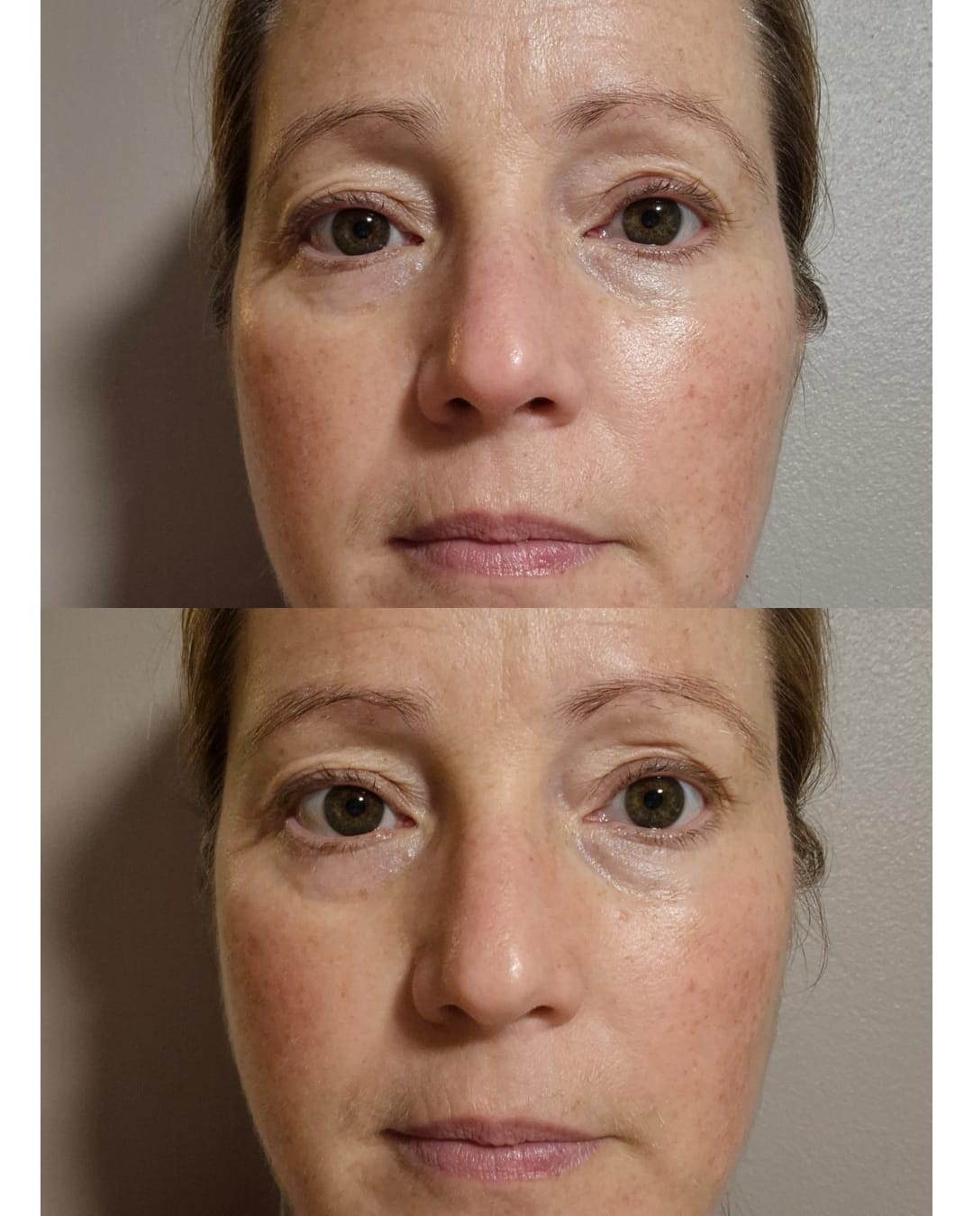 Customer photo review of Bakuchiol Cream
