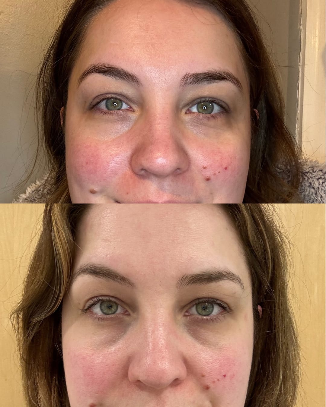 Customer photo review of Bakuchiol Cream