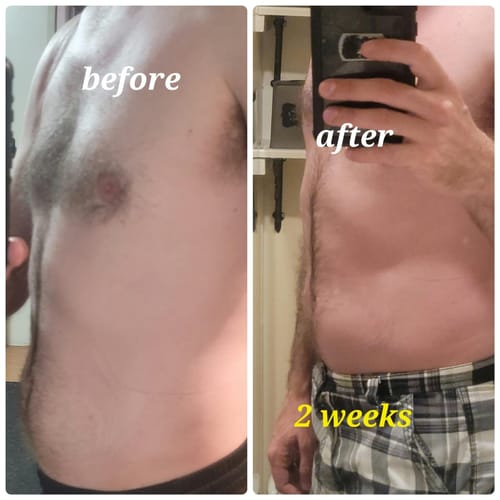 Customer photo review of NextGen Abs Muscle Stimulator